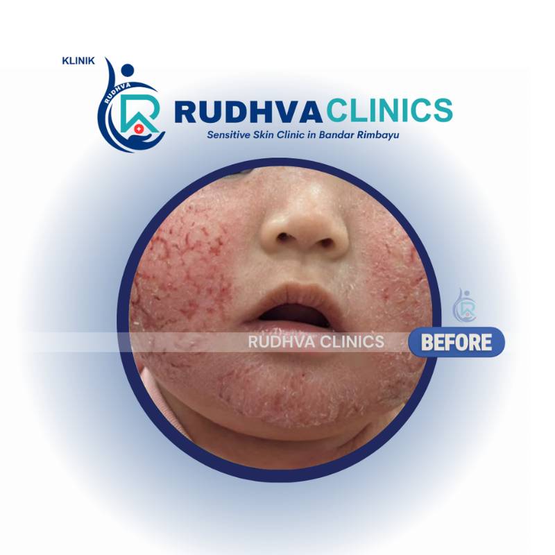 RUDHVA - Pediatric Services (2)