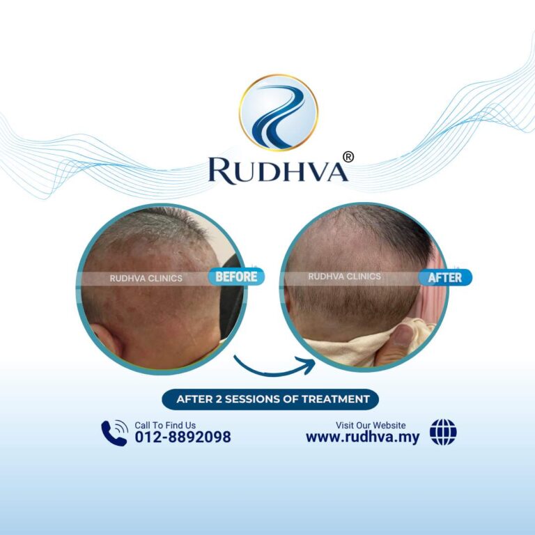 Rudhva - Before & After (Child) 10