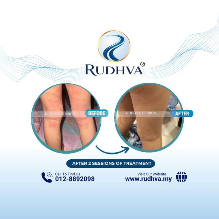 Rudhva - Before & After (Child) 6