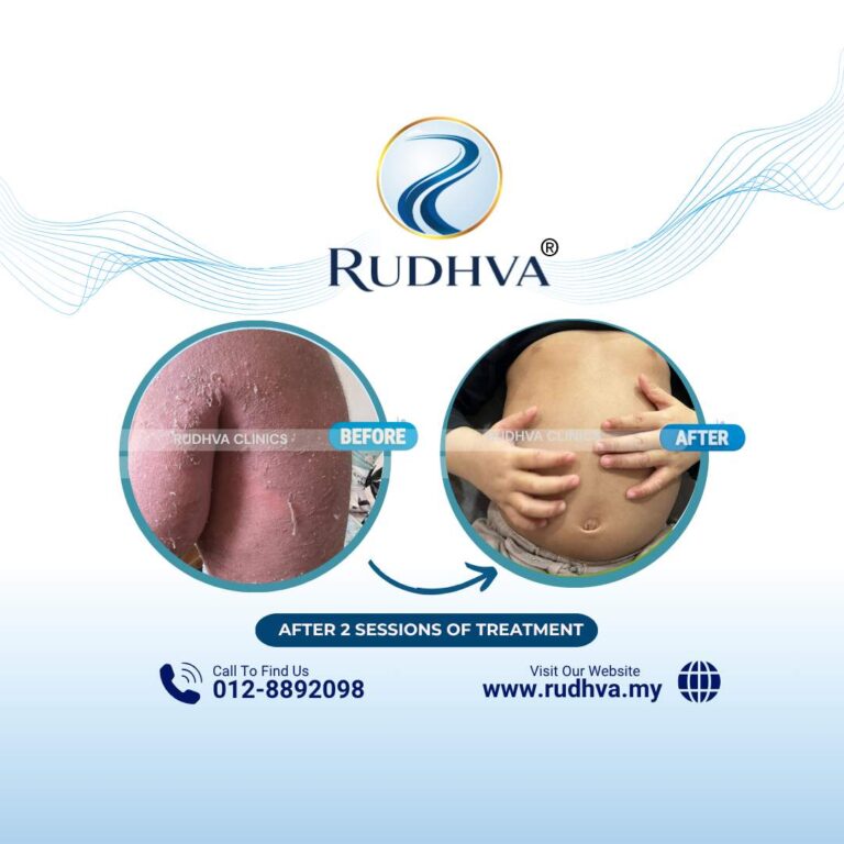 Rudhva - Before & After (Child) 7