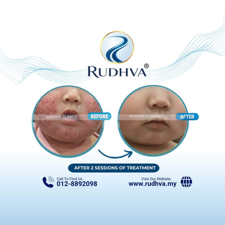Rudhva - Before & After (Child) 9