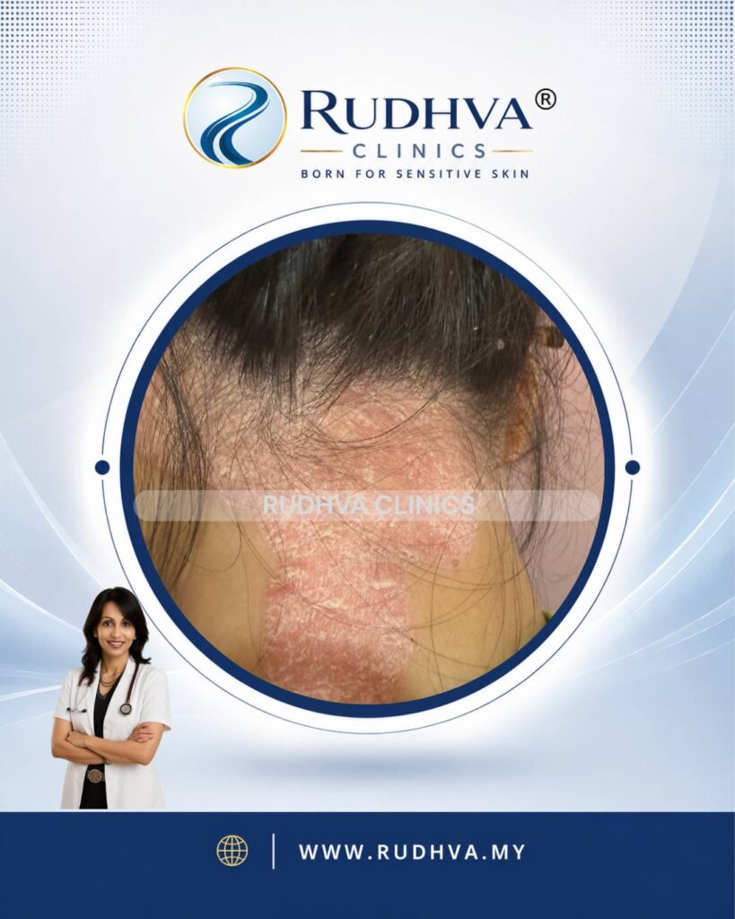 Rudhva - Hair & Scalp 1