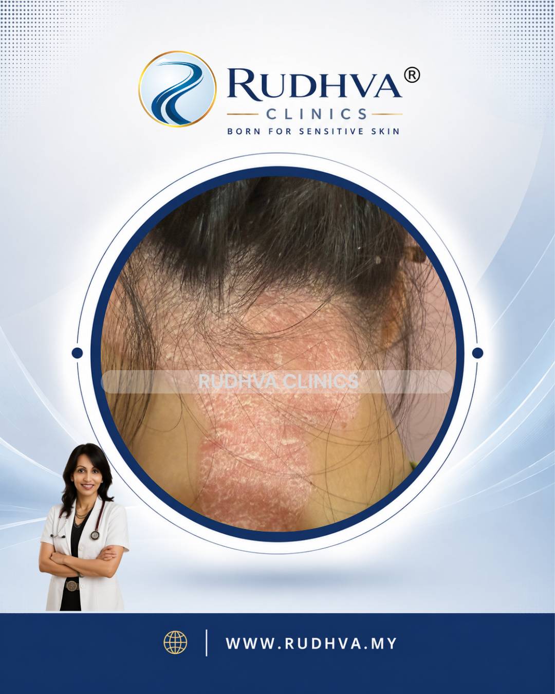 Rudhva - Hair & Scalp 1