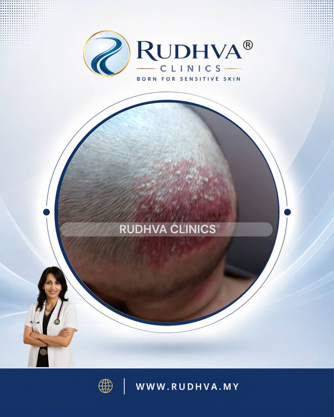 Rudhva - Hair & Scalp 2