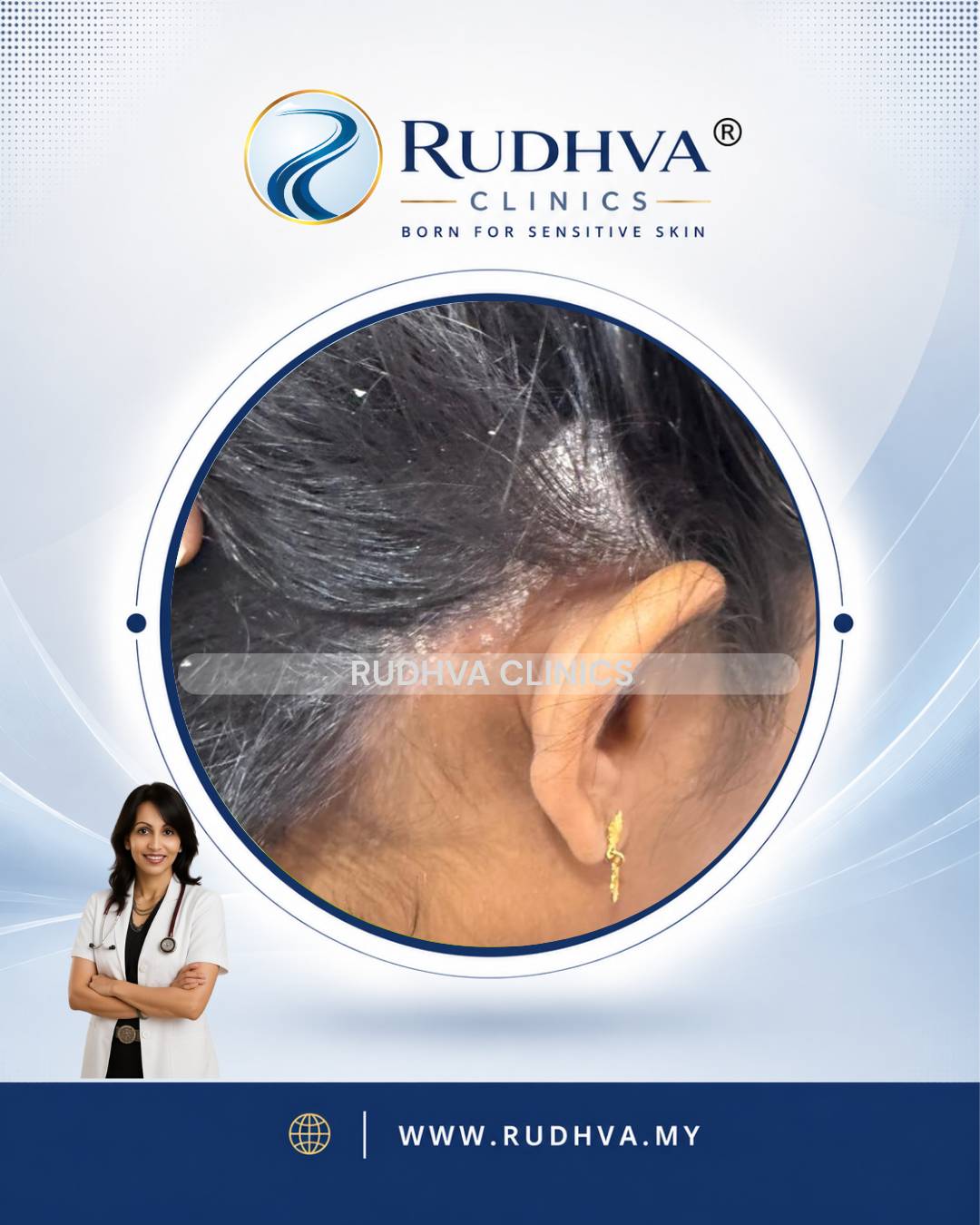 Rudhva - Hair & Scalp 3