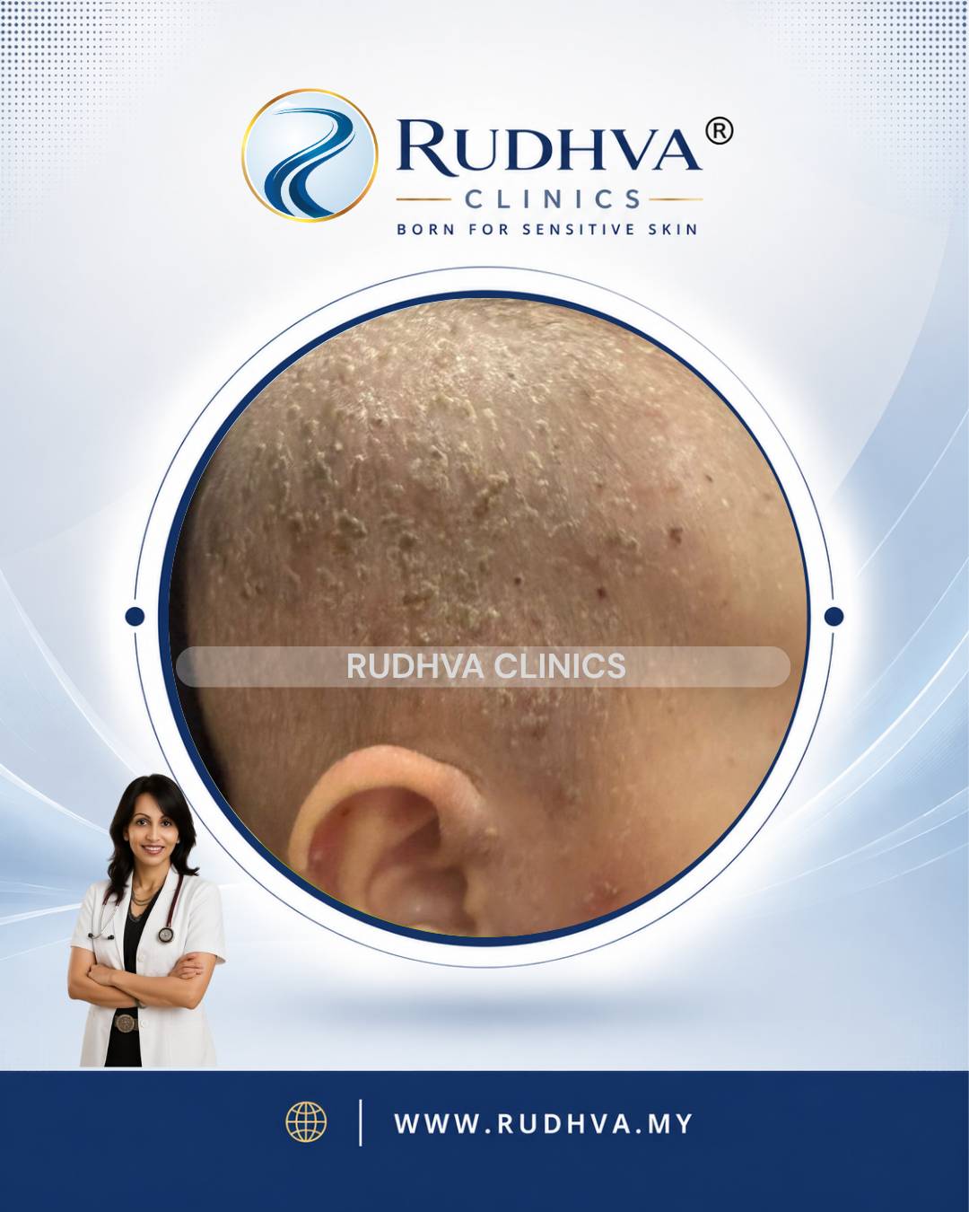 Rudhva - Hair & Scalp 4