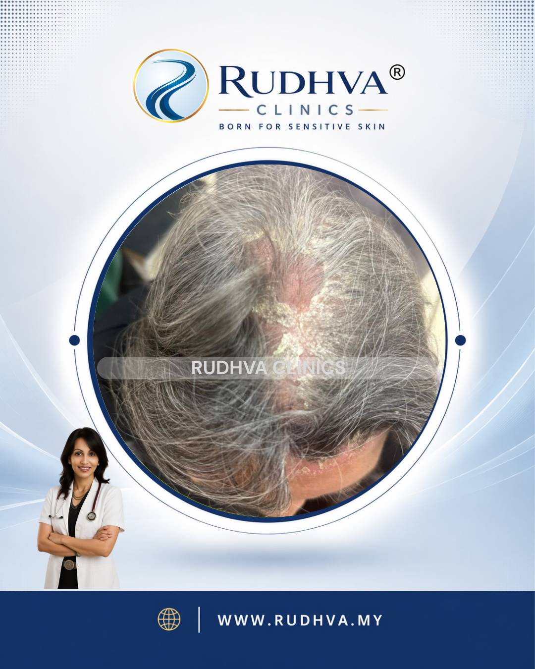 Rudhva - Hair & Scalp 5