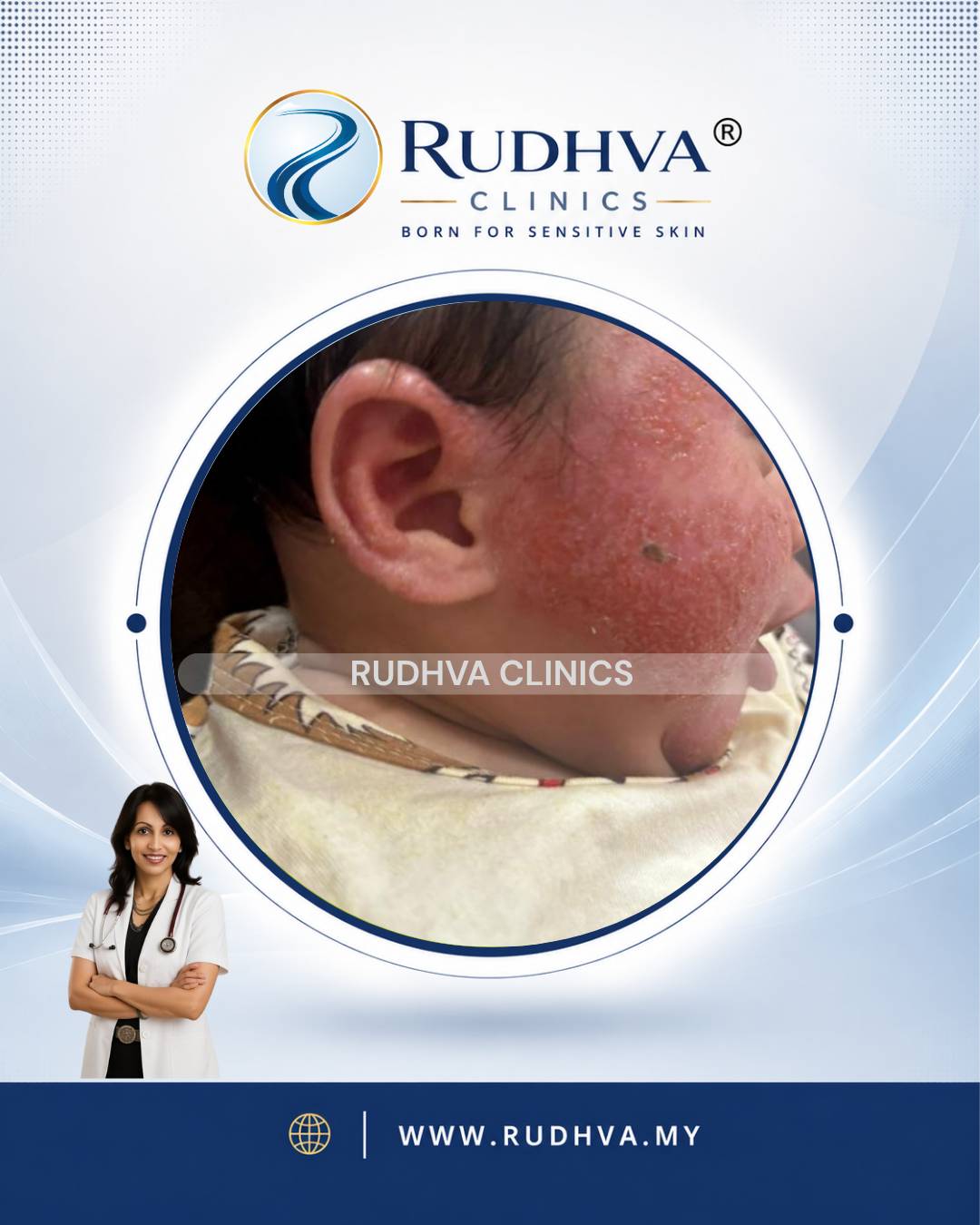 Rudhva - PEDIATRIC DERMATOLOGY 1