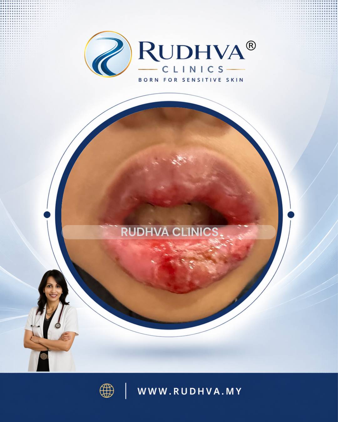 Rudhva - PEDIATRIC DERMATOLOGY 2