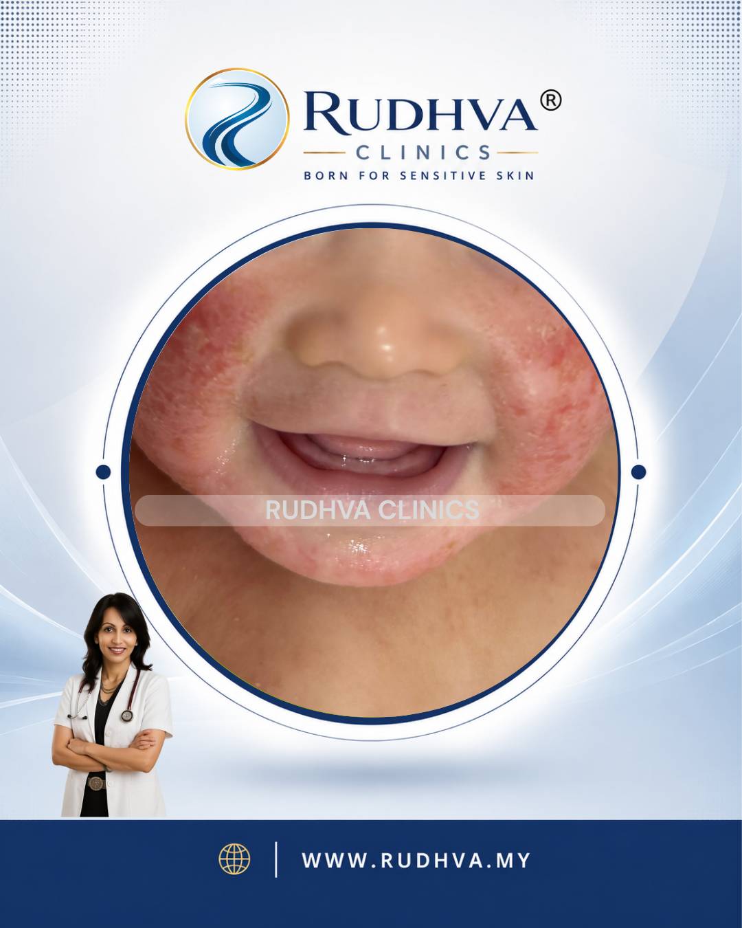 Rudhva - PEDIATRIC DERMATOLOGY 3