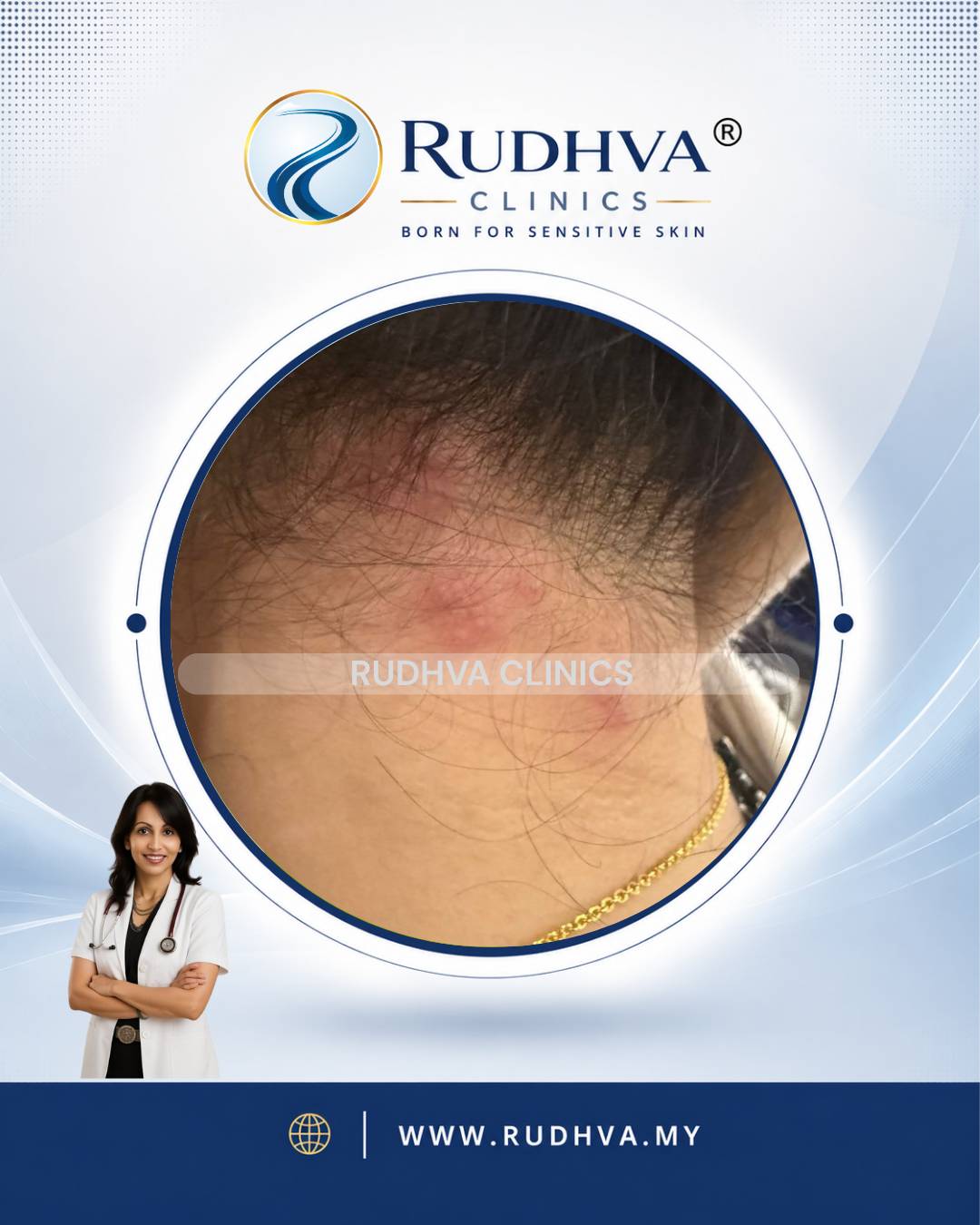 Rudhva - Skin Allergy 3