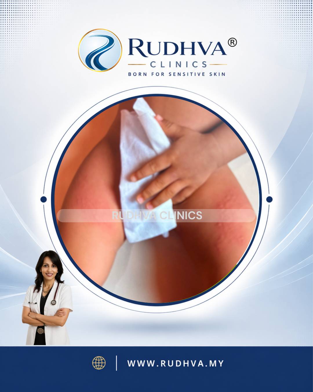 Rudhva - Skin Allergy 5
