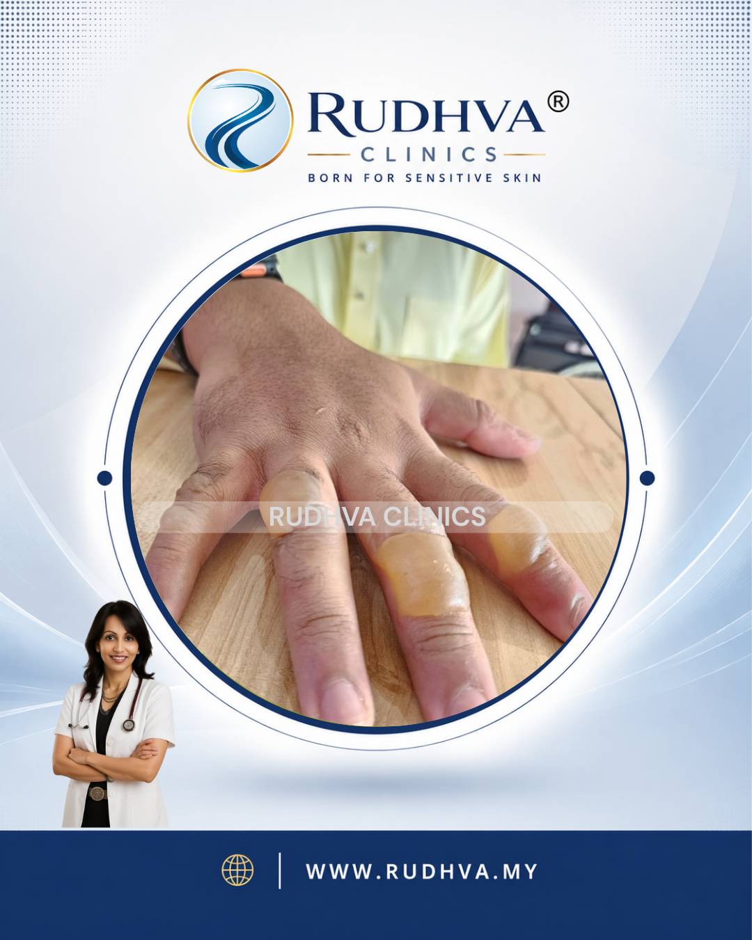 Rudhva - Skin Infection 3